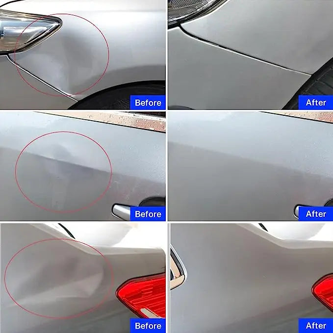Paintless Dent Puller Kit - Auto Hail Repair Suction Cup Set